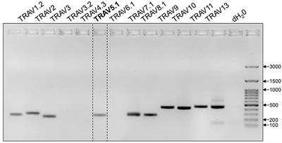 Endogenous T Cell Receptor Rearrangement Represses Aggressive Central Nervous System Autoimmunity in a TcR-Transgenic Model on the Non-Obese Diabetic Background